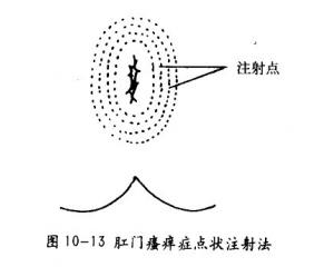 科学检查，10分钟微创根除肛门瘙痒