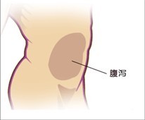 腹泻示意图