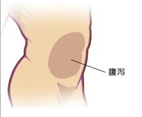 腹泻示意图