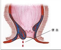 腹泻伴有便血可能昭示肠道炎症